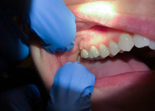 Best Emergency Dental Services for Seniors in Wynantskill, NY